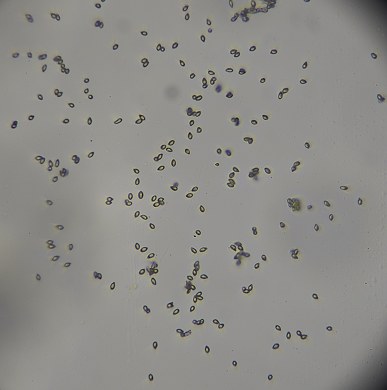 BlicklingHyphomycete040326-4