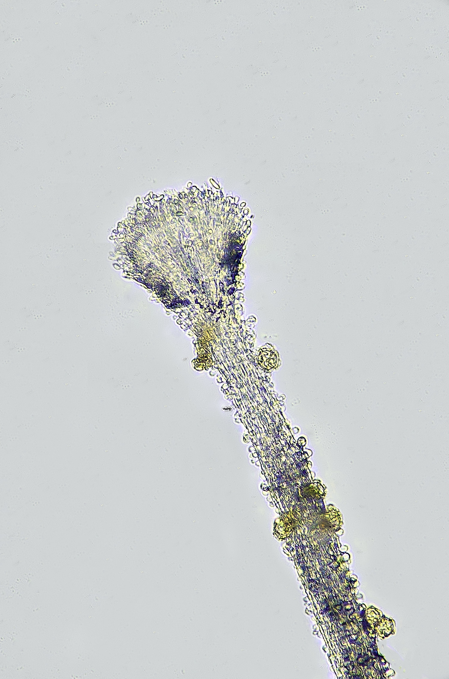 StrumpshawSlimeMoldFungus150326-4