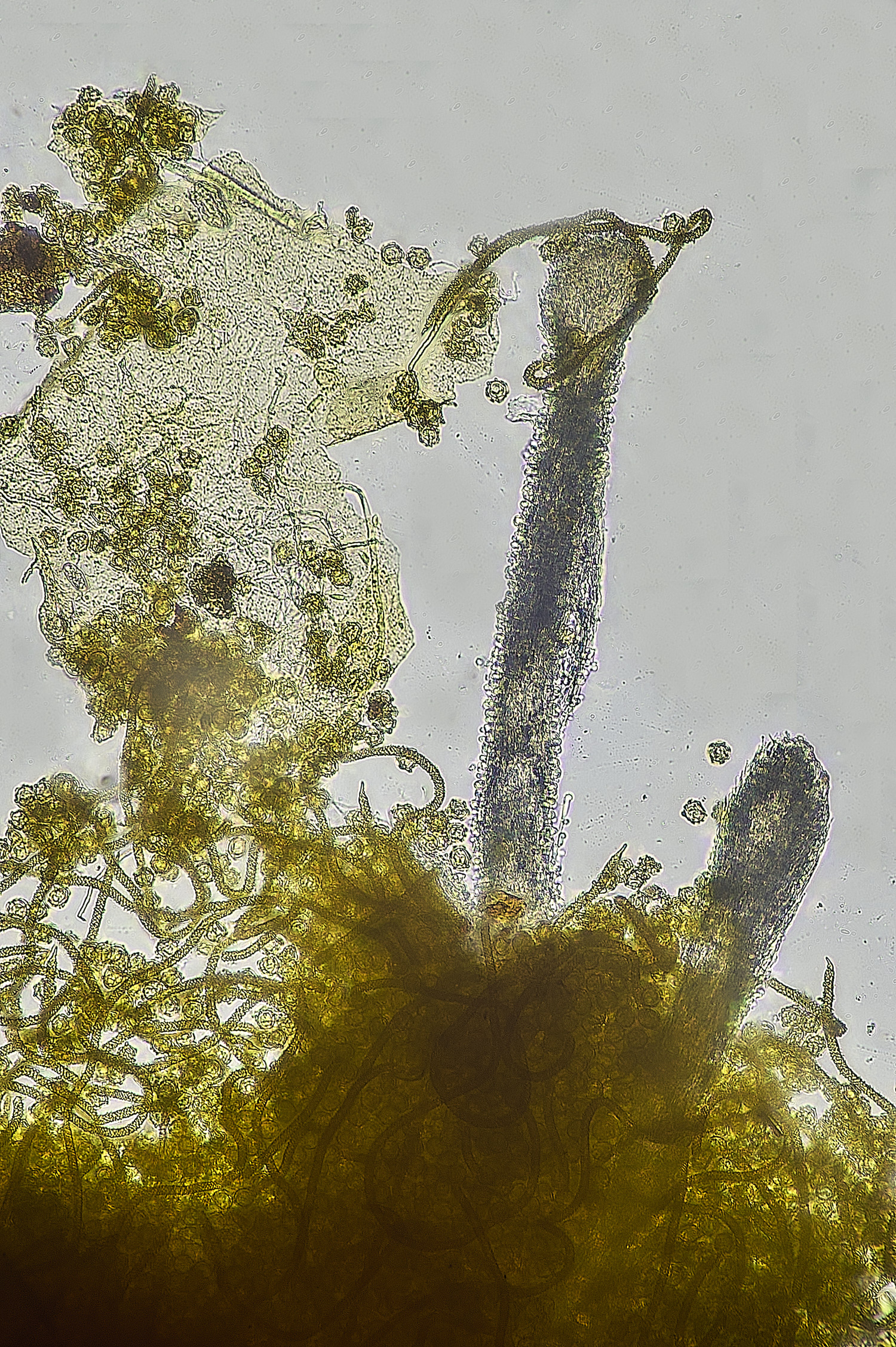 StrumpshawSlimeMoldFungus150326-5