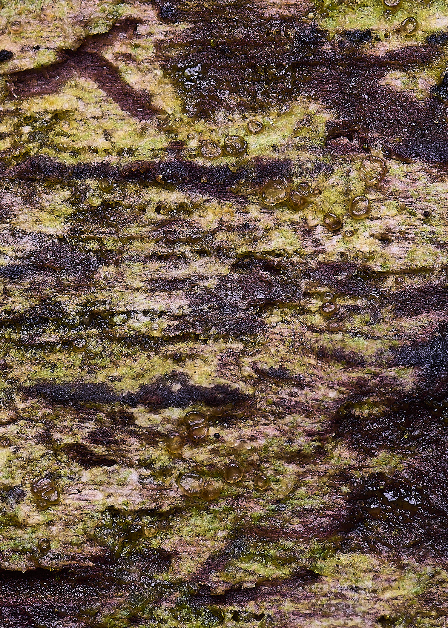 FelbriggJamesiellaanastomosans210226-2